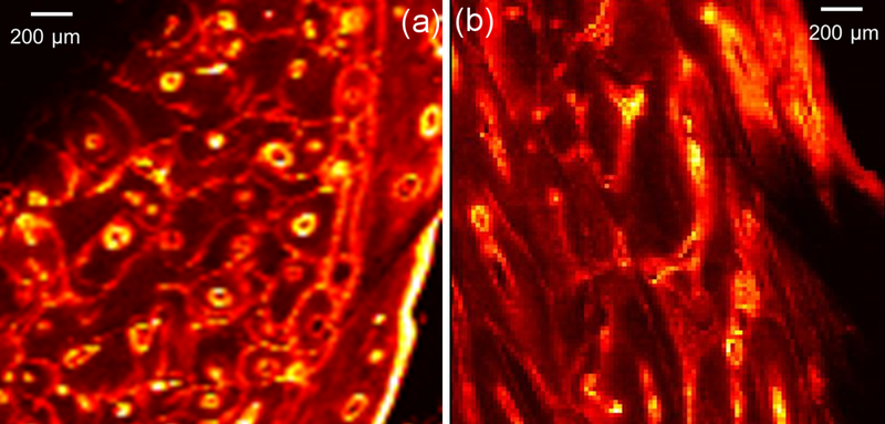 The microscopic details of a crew member’s femur, as seen by confocal X-ray fluorescence imaging. It shows a map of lead concentrations, where the yellow indicates lighter concentrations, and the darker red indicates heavier concentrations.